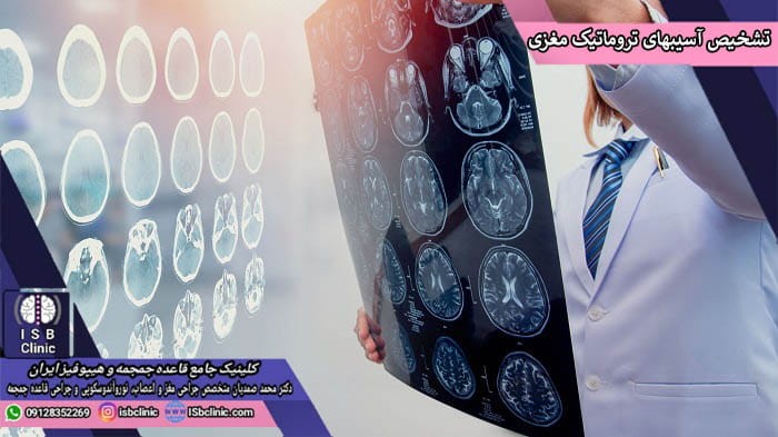 تشخیص آسیب های تروماتیک مغزی