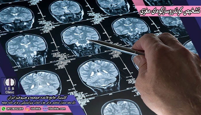 روش های تشخیص کوندرو سارکومای مغزی