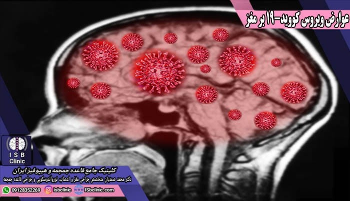 چگونگی آسیب های مغزی بر اثر عوارض ویروس کووید-19