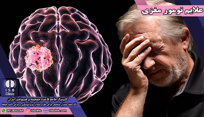 شایع ترین علائم تومور مغزی