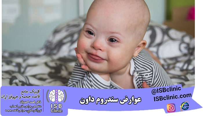 آیا سندروم داون عوارضی به دنبال دارد؟