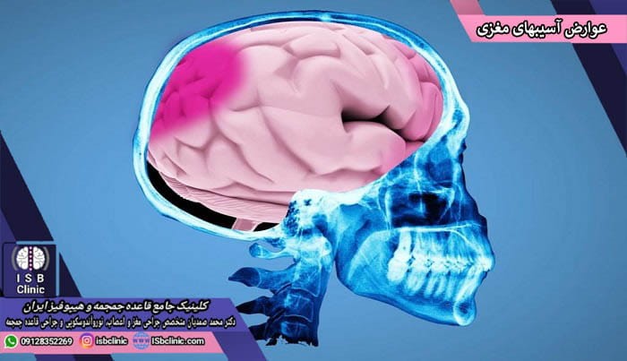 علایم و عوارض آسیب های تروماتیک مغزی