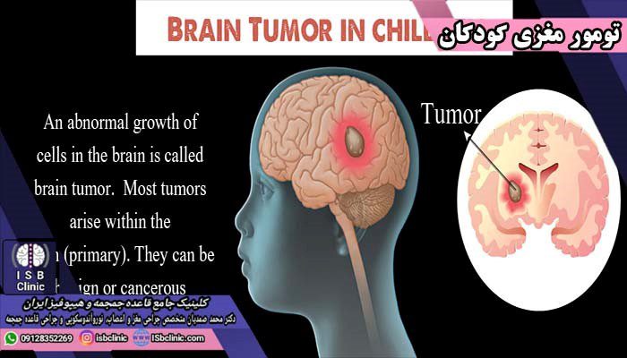 علائم تومور مغزی در کودکان