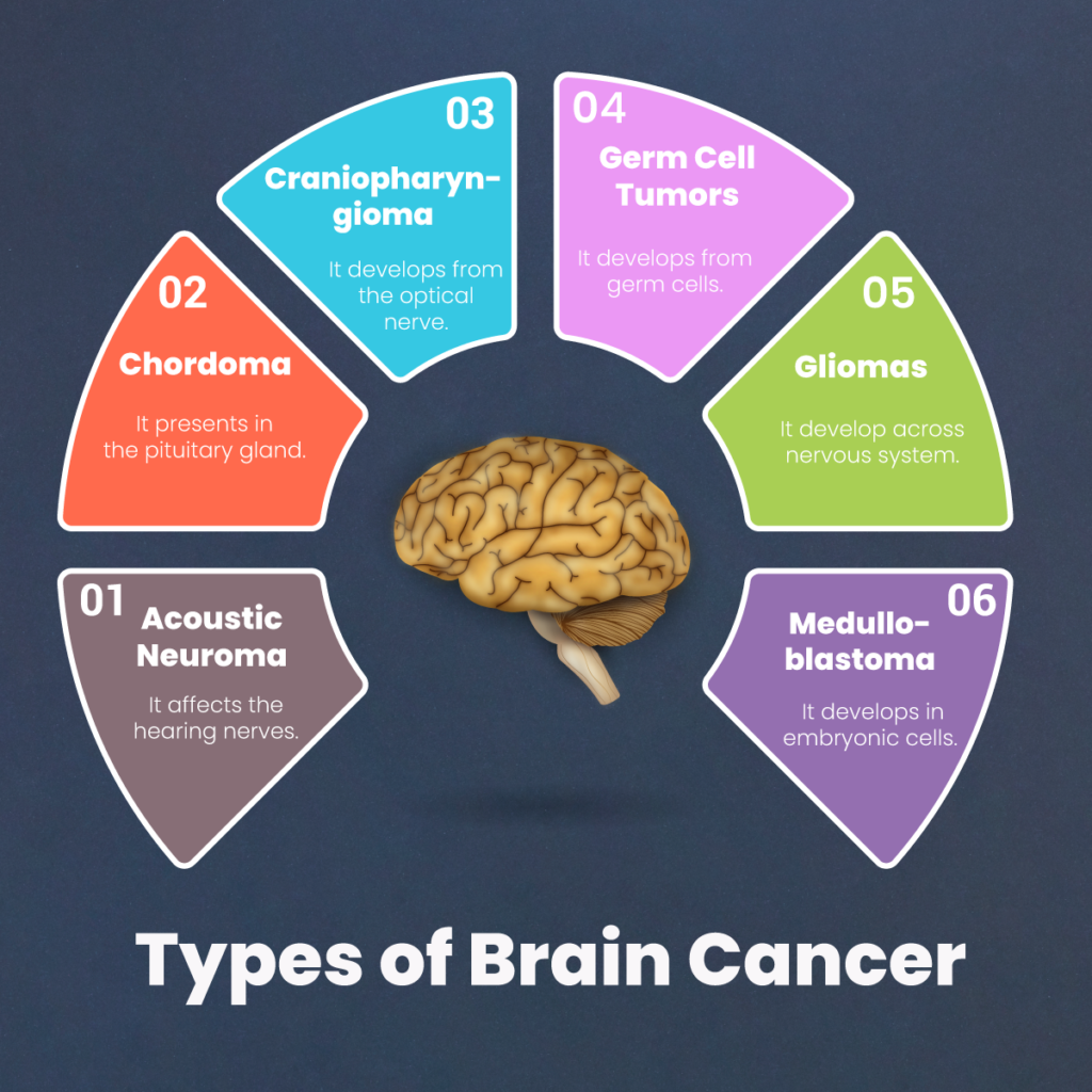 انواع تومور مغزی